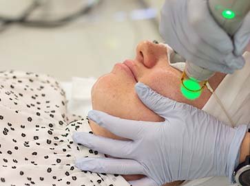 PIGMENTATION WITH LASERS